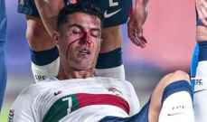لحظة اصابة رونالدو في مباراة تشيكيا