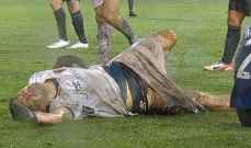 لاعب غريميو يتعرض لاصابة بعد سقوط منافسه عليه بطريقة كوميديا