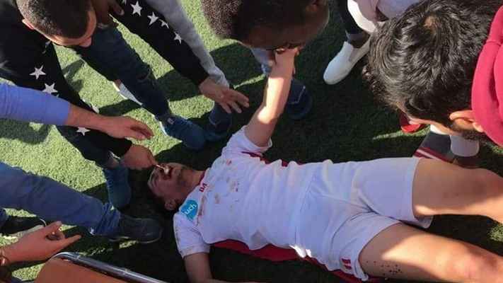 لاعب ينجو من الموت خلال دوري الناشئين في لبنان