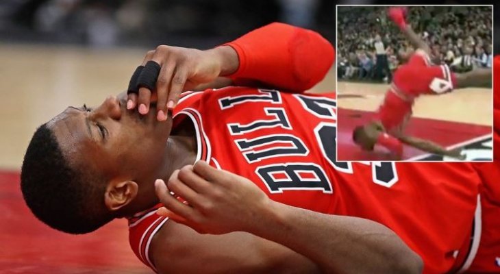 لاعب شيكاغو بولز كريس دان يتعرض لإصابة في وجهه