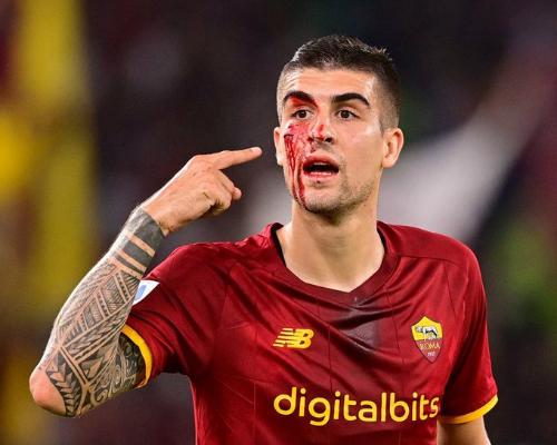 الدّماء تسيل من وجه لاعب روما خلال مواجهة أودينيزي