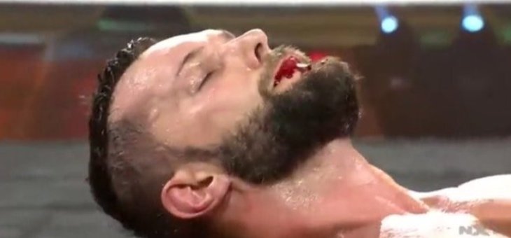 نقل بالور إلى المستشفى بعد مباراته في NXT