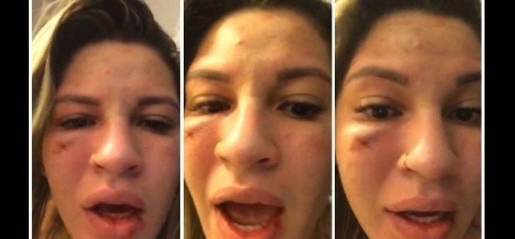 الفيديو الذي يظهر الكدمات على وجه زوجة حارس مرمى ساو باولو